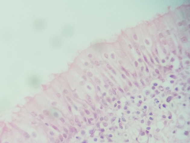 Pseudostratified Epithelium Slides - Pseudostratified Epithelium 10 400X